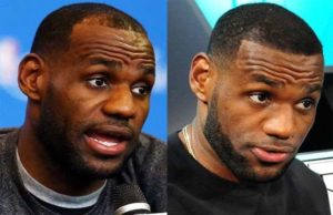 Lebron-James-Hair-Transplant